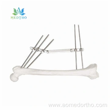 external fracture